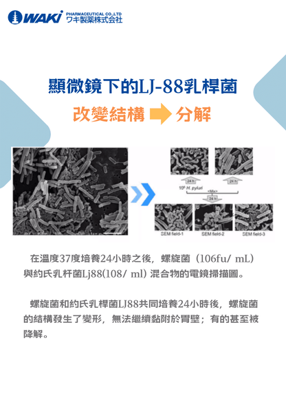 VATY LJ88抗幽益生菌｜助排幽門螺桿菌 × 養護腸胃 × 調節免疫 × 改善便秘 × 全面腸道健康守護