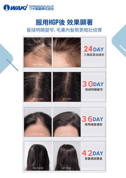 WAKi 菲爾莫生髮素｜フェルモー FELMOO × 喚醒沈睡頭皮 × 還你黑亮豐盈 × 專利HGP生髮多肽 × 日本科研證實