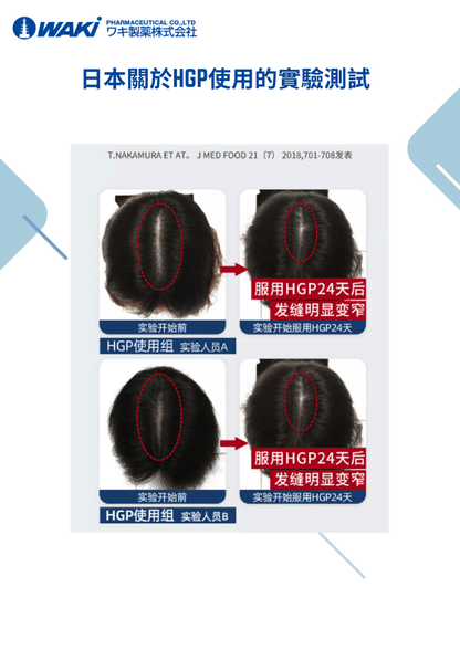 WAKi 菲爾莫生髮素｜フェルモー FELMOO × 喚醒沈睡頭皮 × 還你黑亮豐盈 × 專利HGP生髮多肽 × 日本科研證實